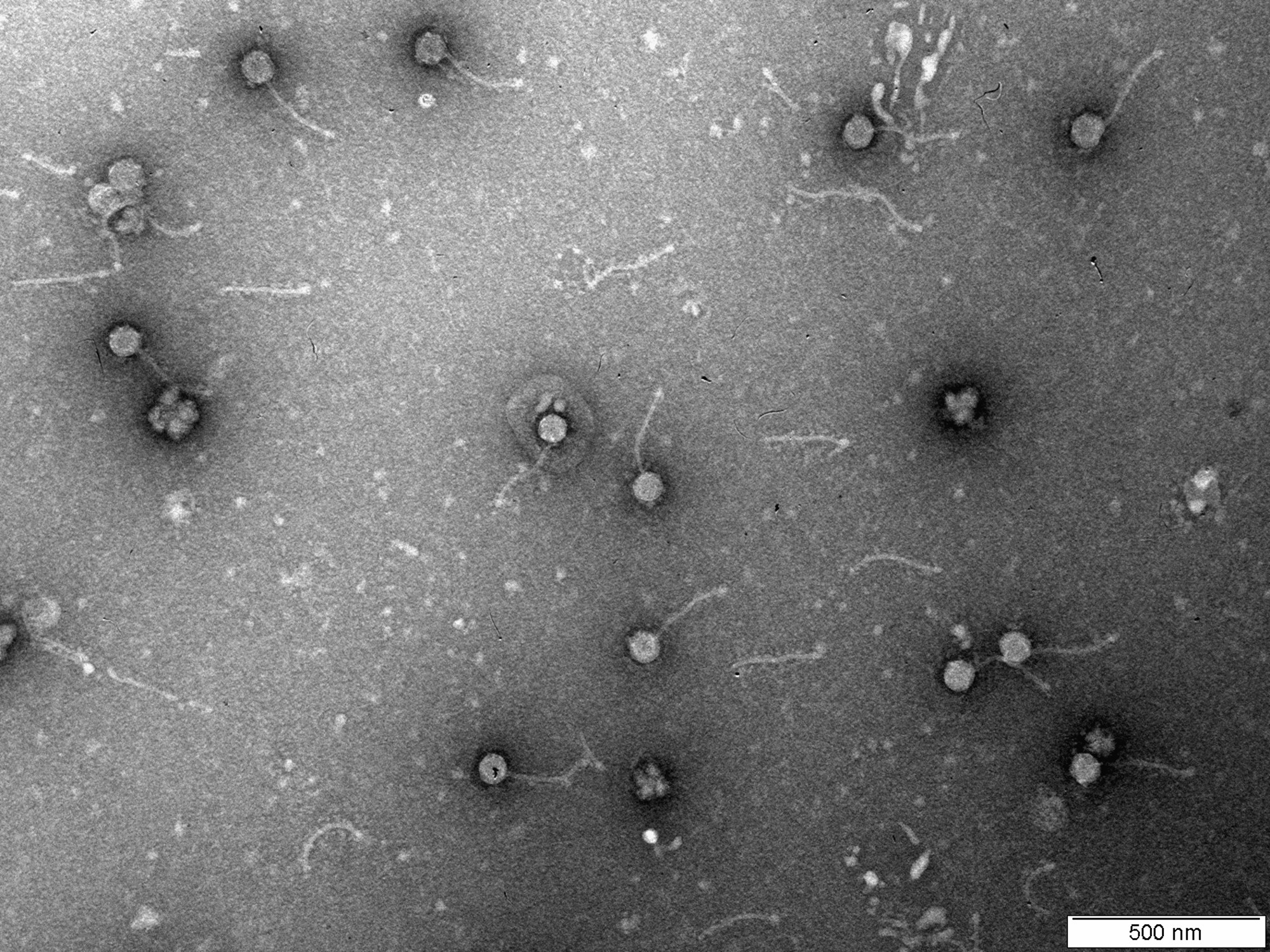 TEM image of a negatively stained virus