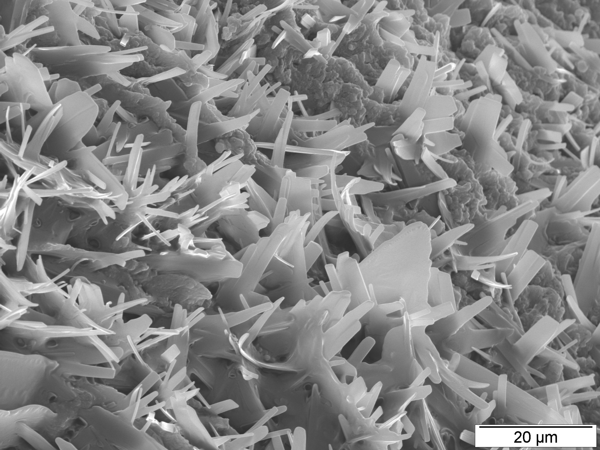 SEM image of cholesterol
