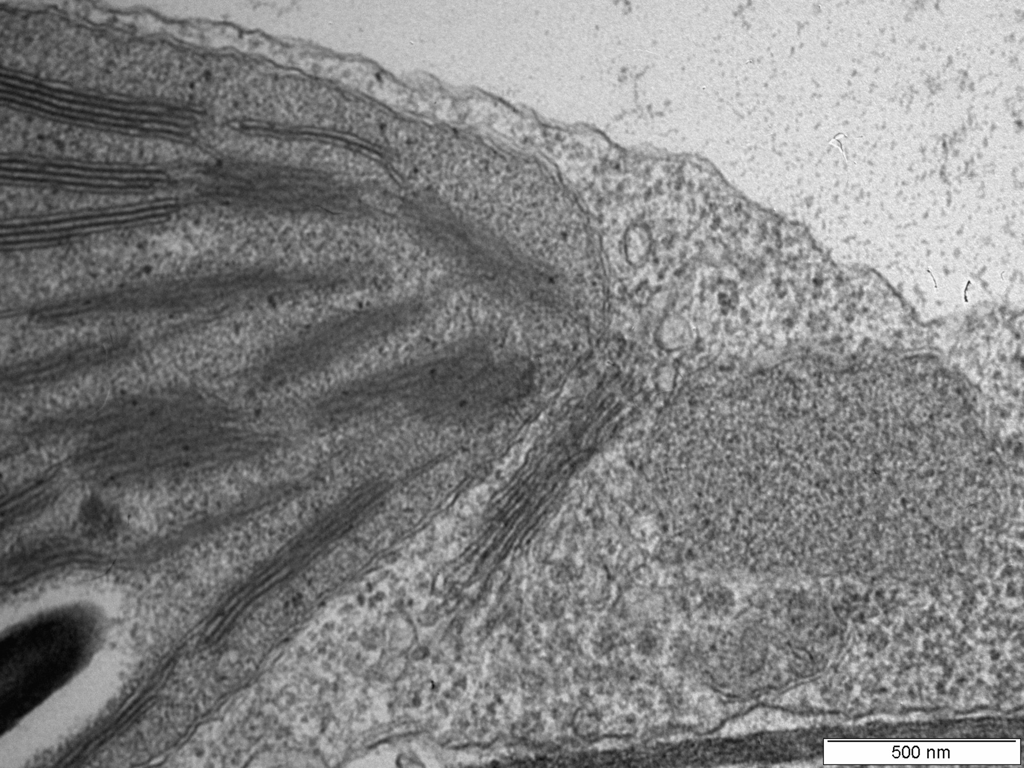 TEM image of plant section showing chloroplast and golgi