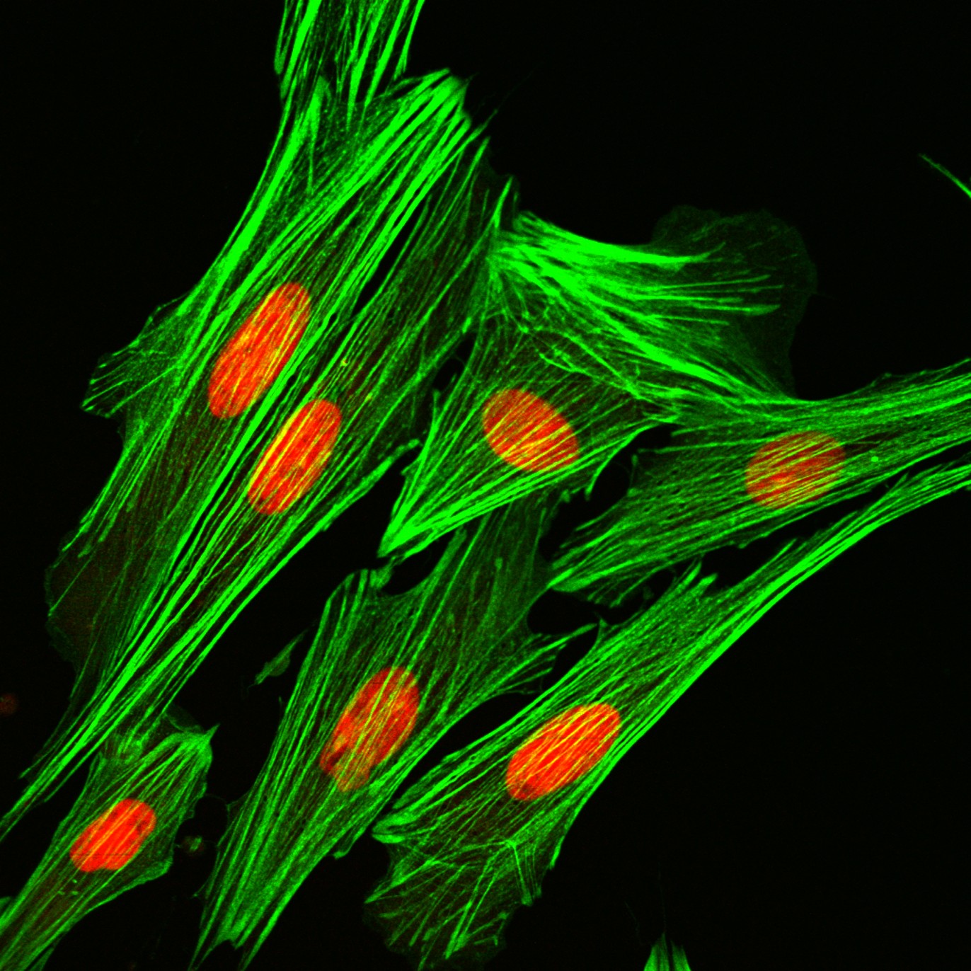 Confocal laser scanning microscope image of cells