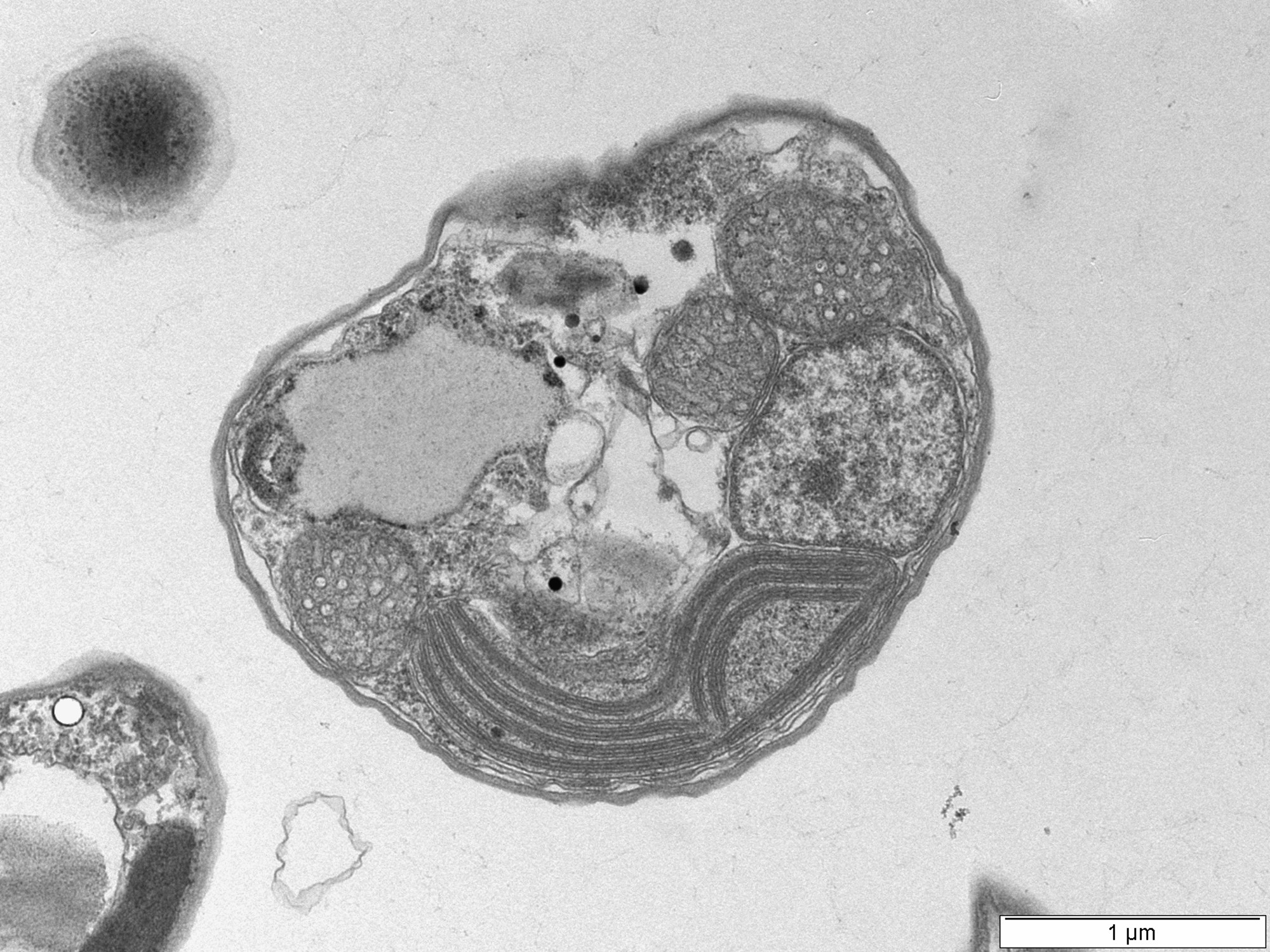 TEM image of unicellular algae