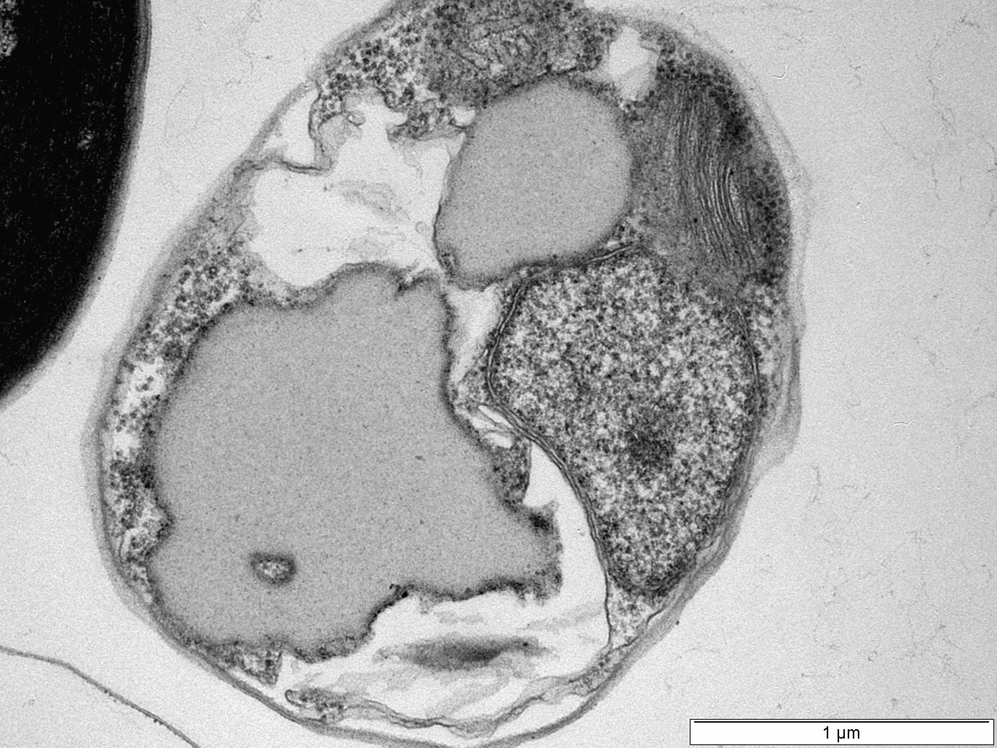 TEM image of a unicellular algae section